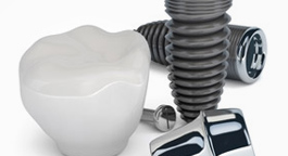 Dental implants