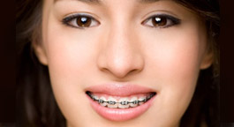 Girl with braces